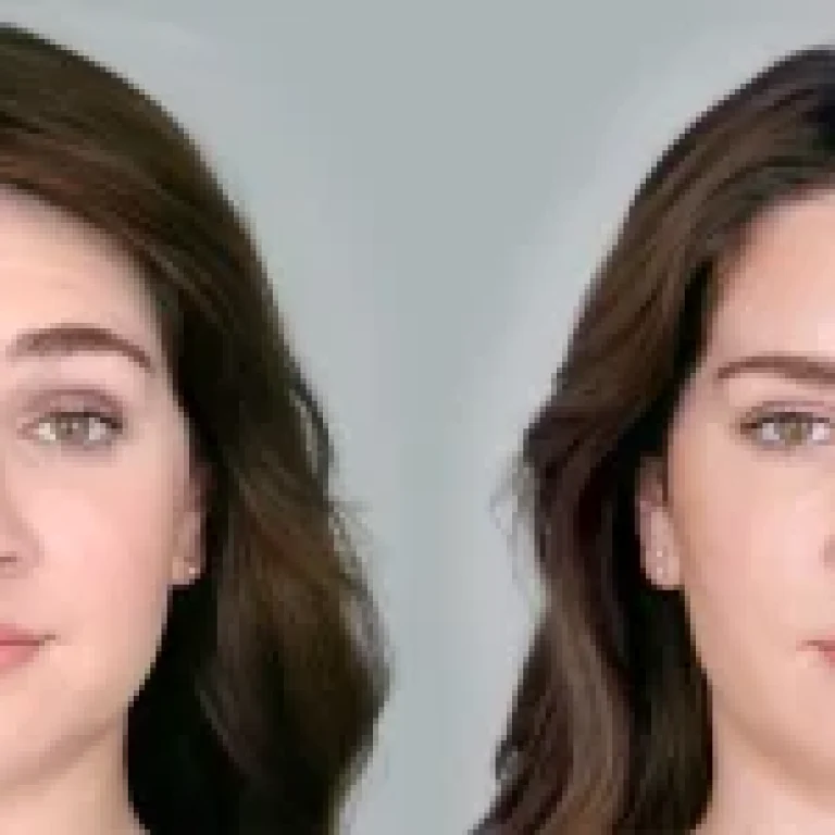 young-female-before-and-after-botox-cosmetic-r6oq1g44bmksxwsporg3eeyexg13dr59g1kndm79wc